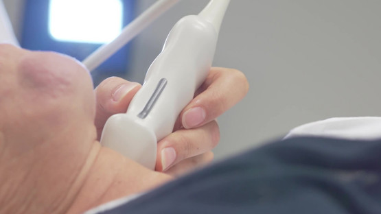 Film: VIPVIZA - Västerbotten Intervention Programme Visualization of Atherosclerosis