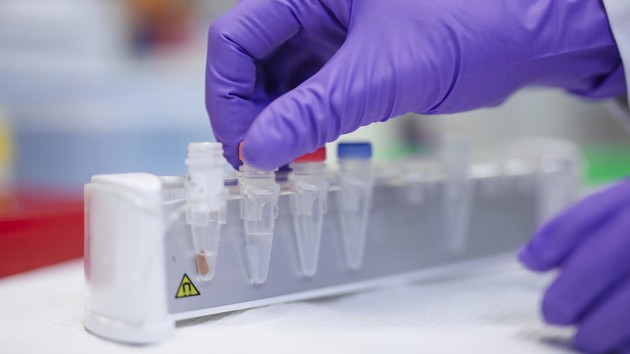 Close-up of a tube rack with microcentrifuge tubes. A hand is about to lift one of the tubes from the rack.