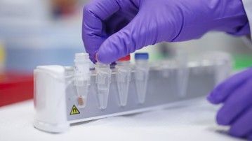 Magnetiska microbeads kopplade till antikroppar mot specifika proteinsekvenser används för att isolera felveckat och aggregerat protein med hjälp av en magnet.