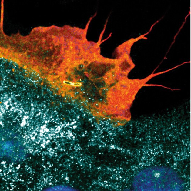 Coloured confocal microscopy immunofluorescence image of a plasma membrane ruffle taking up invasive bacteria into an intestinal epithelial cell. Sample and image acquisition: Dorothee Langenbach; Artistic rendering: Atin Sharma. MIMS, Umeå University.