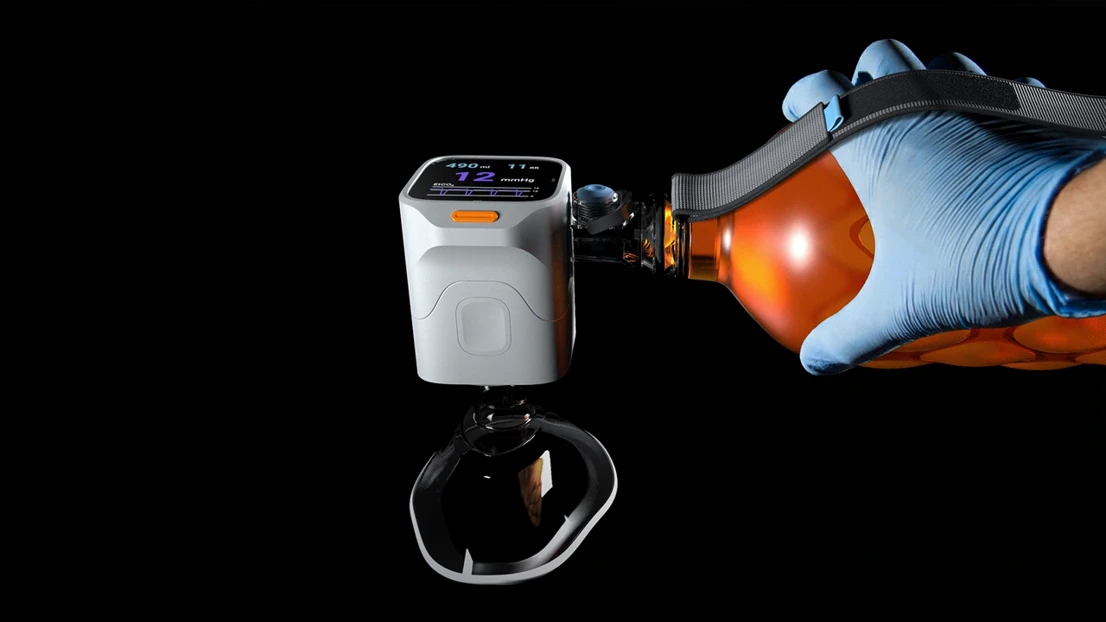 A person in blue gloves is holding a bottle.