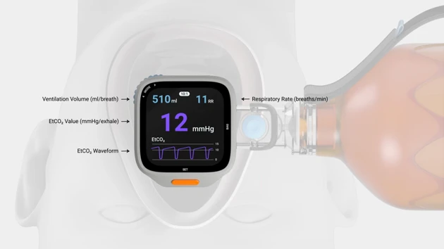 A close up of a blood pressure monitor.