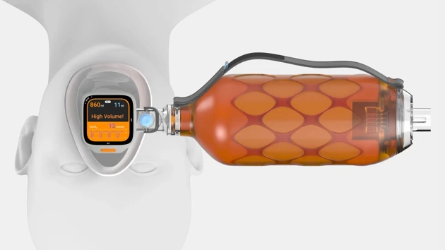 An orange and white device connected to a white object.