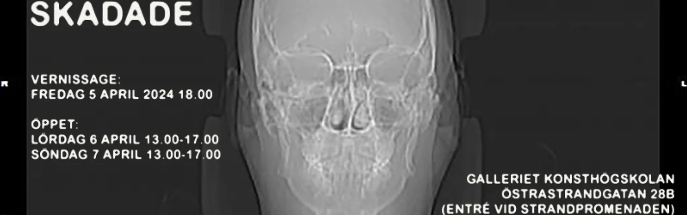 Röntgenbild av mänsklig skalle mot svart bakgrund