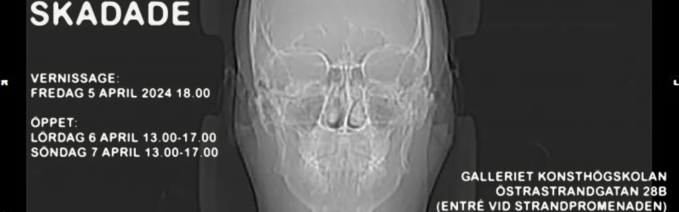 X-ray image of a human skull against a black background