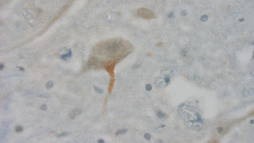 Bild på helveckad protein i nervcell