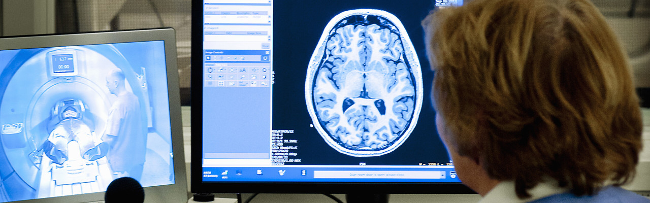 Bild på MRI skärmbild vid UFBI