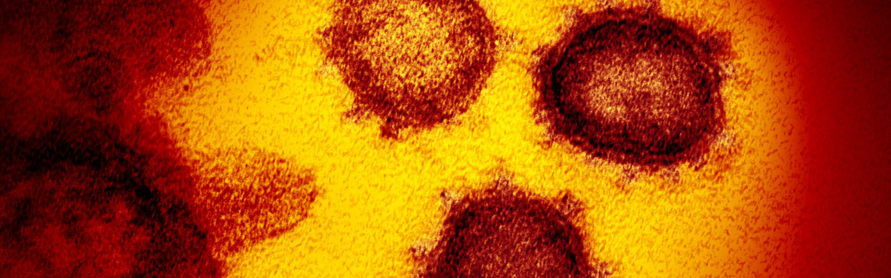 Coronavirus SARS-CoV-2