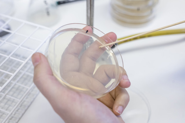 Bacteria on a plate, Umeå University